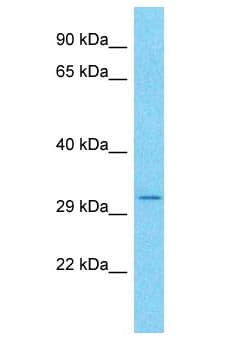 CCDC101 Antibody (aa98-147)