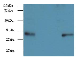 Polyclonal Rabbit anti-Human PIH1D1 Antibody (IHC, WB)