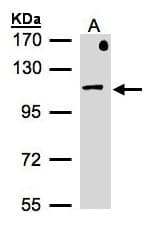 Polyclonal Rabbit anti-Human AP2B1 Antibody (aa384-609, WB)