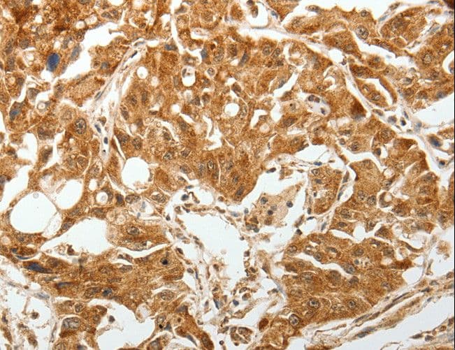 Polyclonal Rabbit anti-Human TGFBR1 / ALK5 Antibody (IHC)