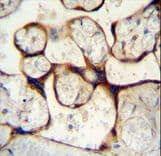 Polyclonal Rabbit anti-Human ECE-1 Antibody (aa391-420, IHC, WB)