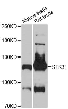 STK31 Antibody