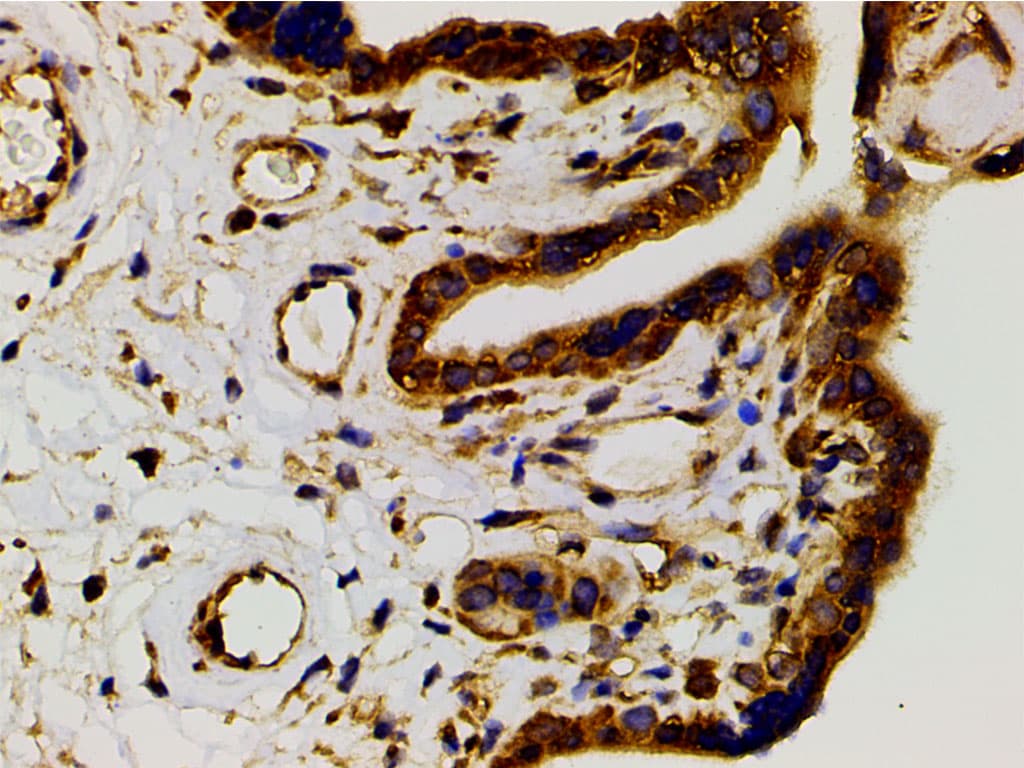 PIK3R1 / p85 Alpha Antibody (phospho-Tyr607)