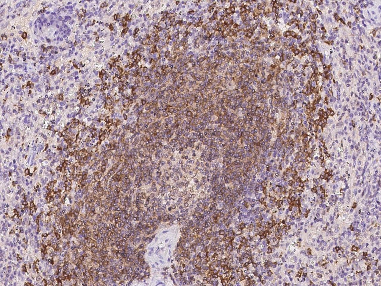 CD22 Antibody