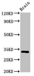 Polyclonal Rabbit anti-Human TMEM142A / ORAI1 Antibody (IHC, WB)