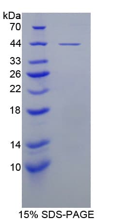 Mouse LTBP1 / LTBP-1 Protein (Recombinant His-T7)