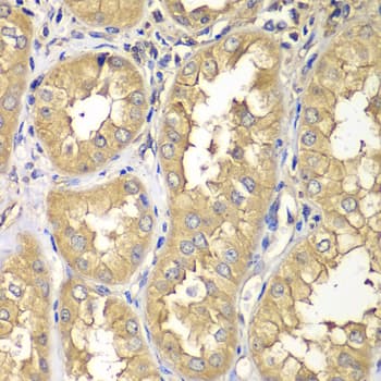 Polyclonal Rabbit anti-Human RAB5C Antibody (IHC, WB)