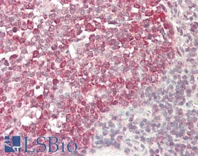 IHC-plus™ RNF182 Antibody (aa1-30)