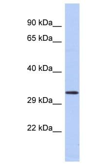 GABRB2 Antibody (aa80-129)