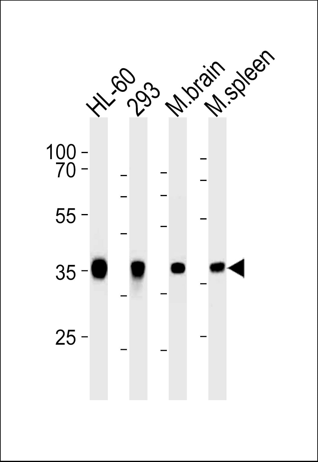 Monoclonal Mouse anti-Human ALDOC / Aldolase C Antibody (clone 859CT9.5.3, WB)