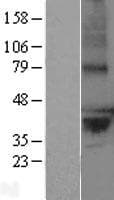 LPPR2 Protein (Over-Expression Lysate Myc-DDK (Flag))
