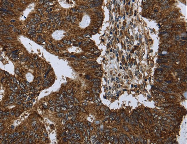 PPP1R13L / iASPP Antibody