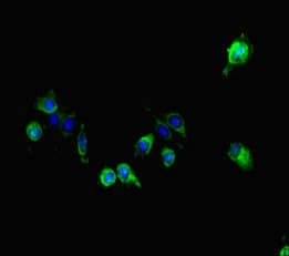 Polyclonal Rabbit anti-Human GALNT11 Antibody (IHC, IF)