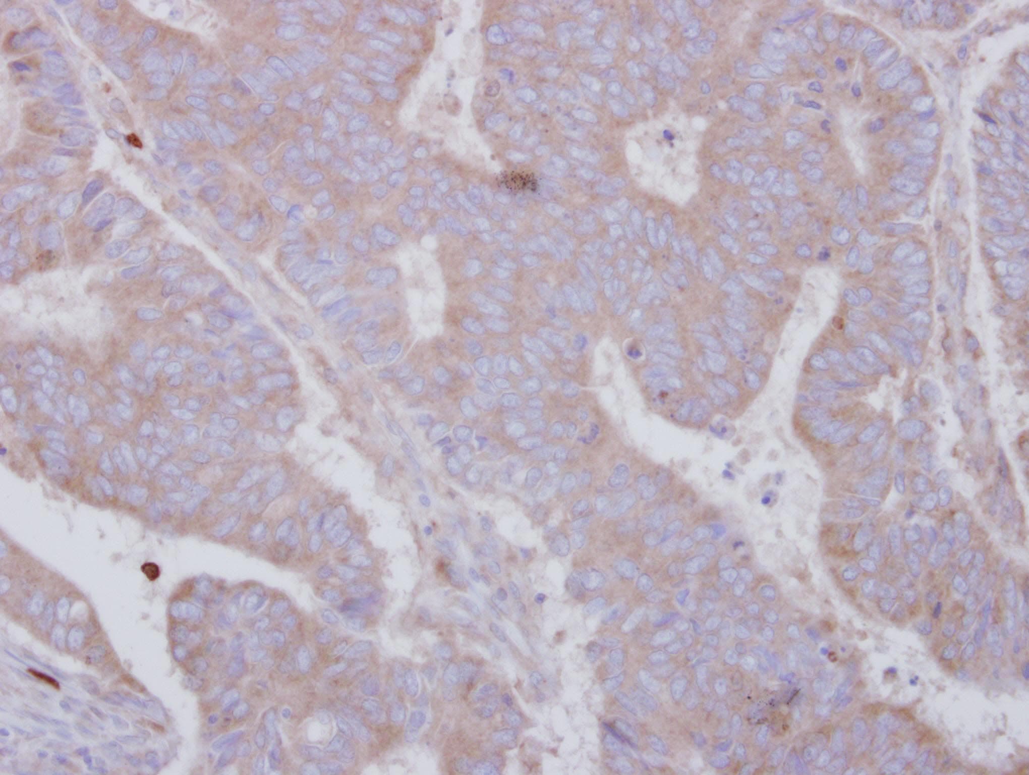 SMYD3 Antibody