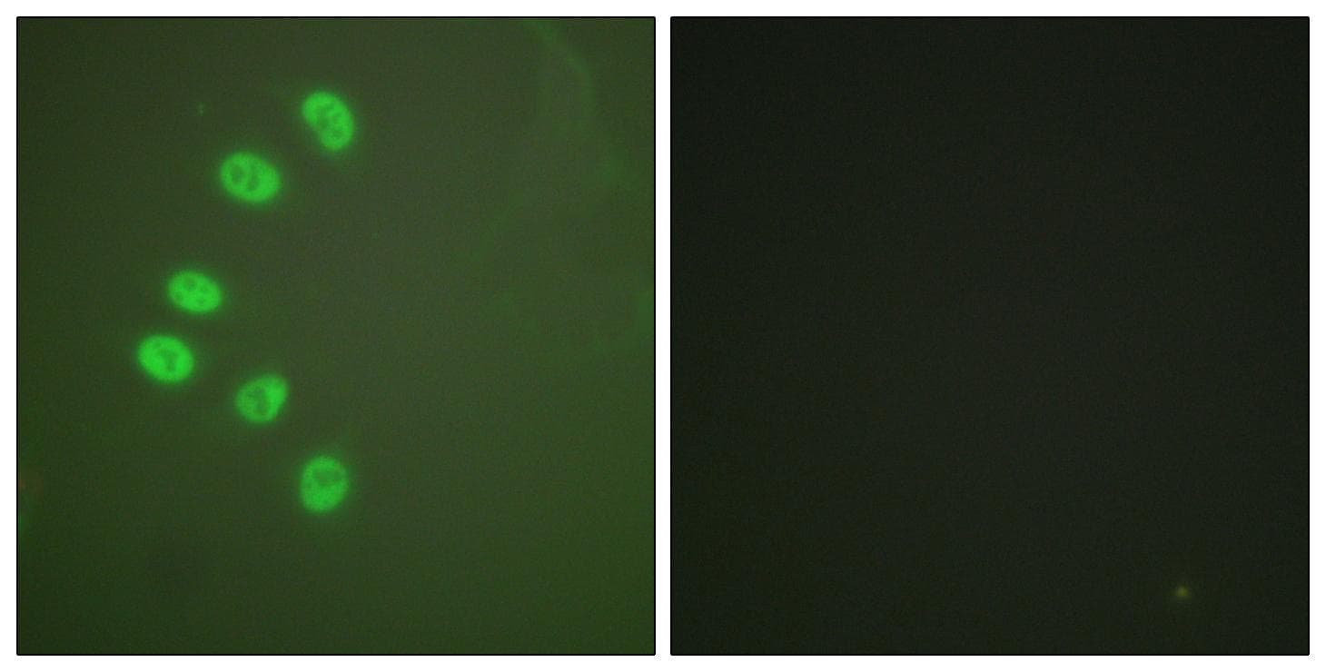 Polyclonal Rabbit anti-Human PR / Progesterone Receptor Antibody (Ab-294, IHC, IF)