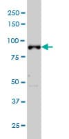 IHC-plus™ Monoclonal Mouse anti-Human ARNT / HIF-1-Beta Antibody (clone 3D10, IHC, IF, WB)