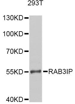 RAB3IP / RABIN3 Antibody