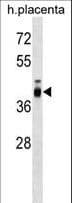 ZP3 Antibody (aa353-380)