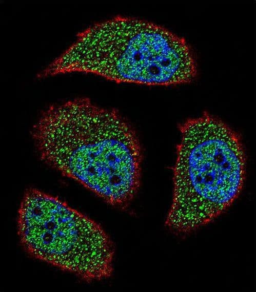 Polyclonal Rabbit anti-Human NIX / BNIP3L Antibody (aa52-81, IHC, IF, WB)