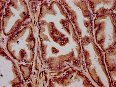 TMEM79 Antibody
