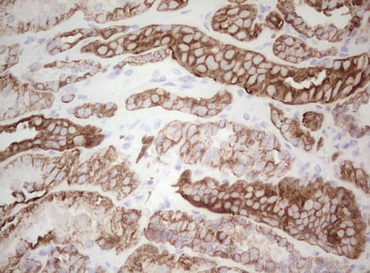 Monoclonal Mouse anti-Human Basic Cytokeratin AE3 Antibody (clone AE3, Carrier-free, IHC)