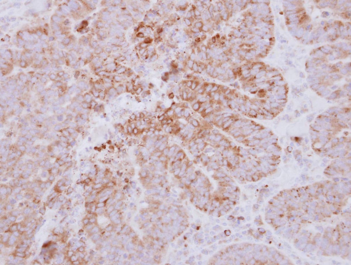 Polyclonal Rabbit anti-Human GYG2 Antibody (aa1-215, IHC, WB)