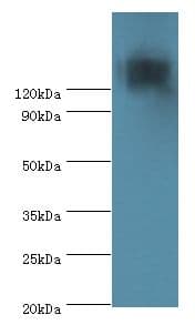 Polyclonal Rabbit anti-Human TP53BP2 / ASPP2 Antibody (aa360-600, WB)