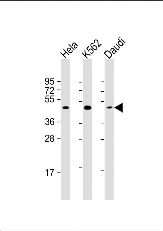 PLIN3 / M6PRBP1 / TIP47 Antibody (clone 1651CT157.85.94)