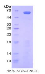 Mouse IGFBP2 / IGF-BP53 Protein (Recombinant His-GST)