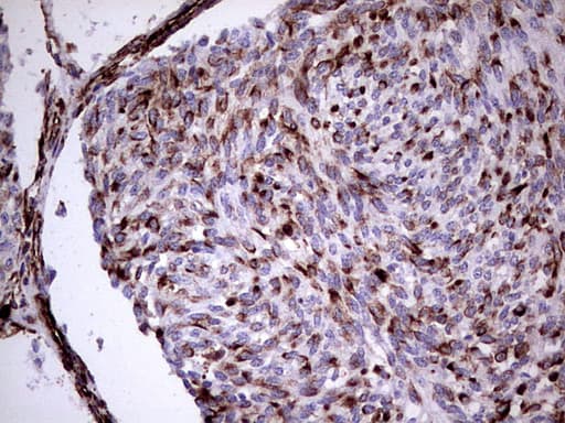 Monoclonal Mouse anti-Human Vimentin Antibody (clone UMAB159, Carrier-free, aa210-466, IHC, IF, WB)