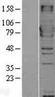 Human MX1 / MX Protein (Over-Expression Lysate Myc-DDK (Flag))