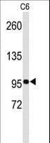 Polyclonal Rabbit anti-Human EPHB3 / EPH Receptor B3 Antibody (WB)