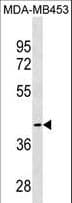 CCBL1 Antibody (aa327-355)