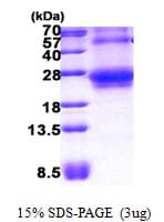 Human RHOQ / TC10 Protein (Recombinant His)