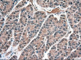 NTF3 / Neurotrophin 3 Antibody (clone OTI5C7)