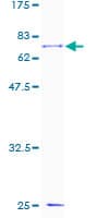 Human ARA55 / HIC-5 Protein (Recombinant GST)