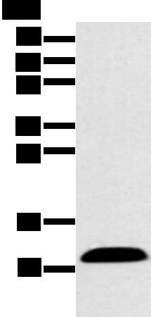 CXCL7 / PPBP Antibody