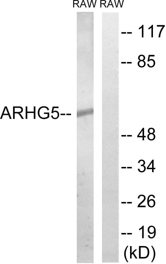 ARHGEF5 Antibody