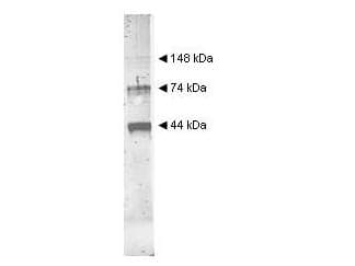 Polyclonal Rabbit anti-Yeast Yeast Alcohol Dehydrogenase (ADH) Antibody (WB)