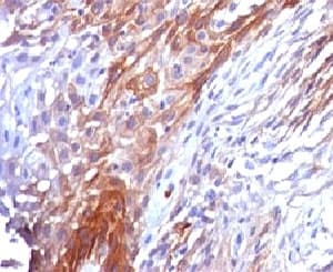 KRT17 / CK17 / Cytokeratin 17 Antibody (clone CTKN17-1, Ready-to-Use)