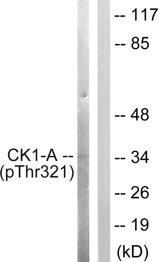Polyclonal Rabbit anti-Human CSNK1A1 / CK1 Alpha Antibody (phospho-Tyr321, WB)