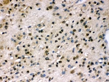 Polyclonal Rabbit anti-Human PPP1R12A / MYPT1 Antibody (IHC, WB)