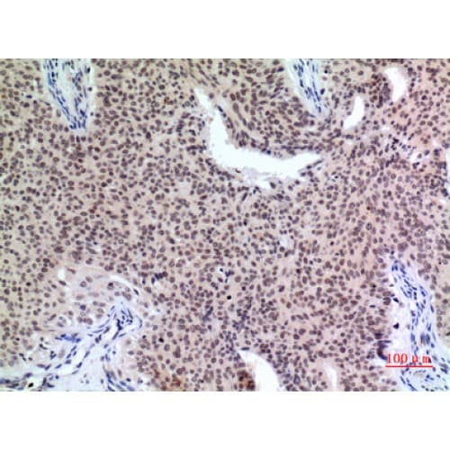 CDKN1C / p57 Kip2 Antibody