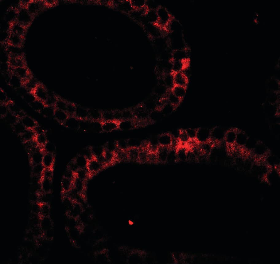IHC-plus™ DIS3 Antibody