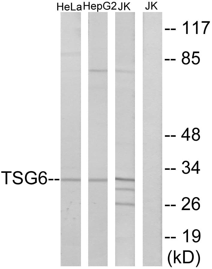 Polyclonal Rabbit anti-Human TNFAIP6 / TSG-6 Antibody (aa21-70, WB)