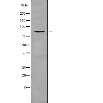 Polyclonal Rabbit anti-Human NPHP1 / Nephronophthisis Antibody (WB)