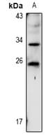 RARRES1 Antibody