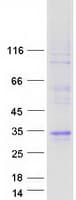Human LCN9 Protein (Recombinant Myc-DDK (Flag))