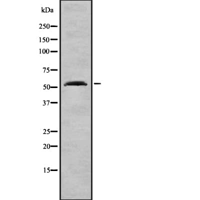 GCK / Glucokinase Antibody