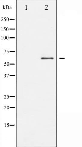 SRC Antibody (phospho-Tyr418)